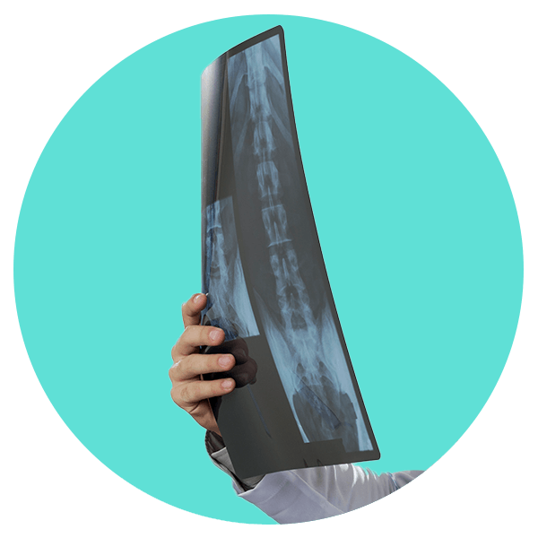 radiografías para hernia de disco
