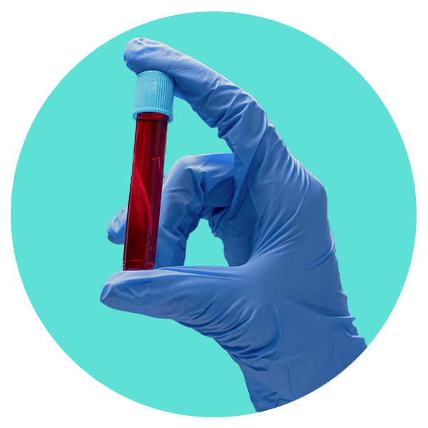 análisis de sangre para hernia de disco