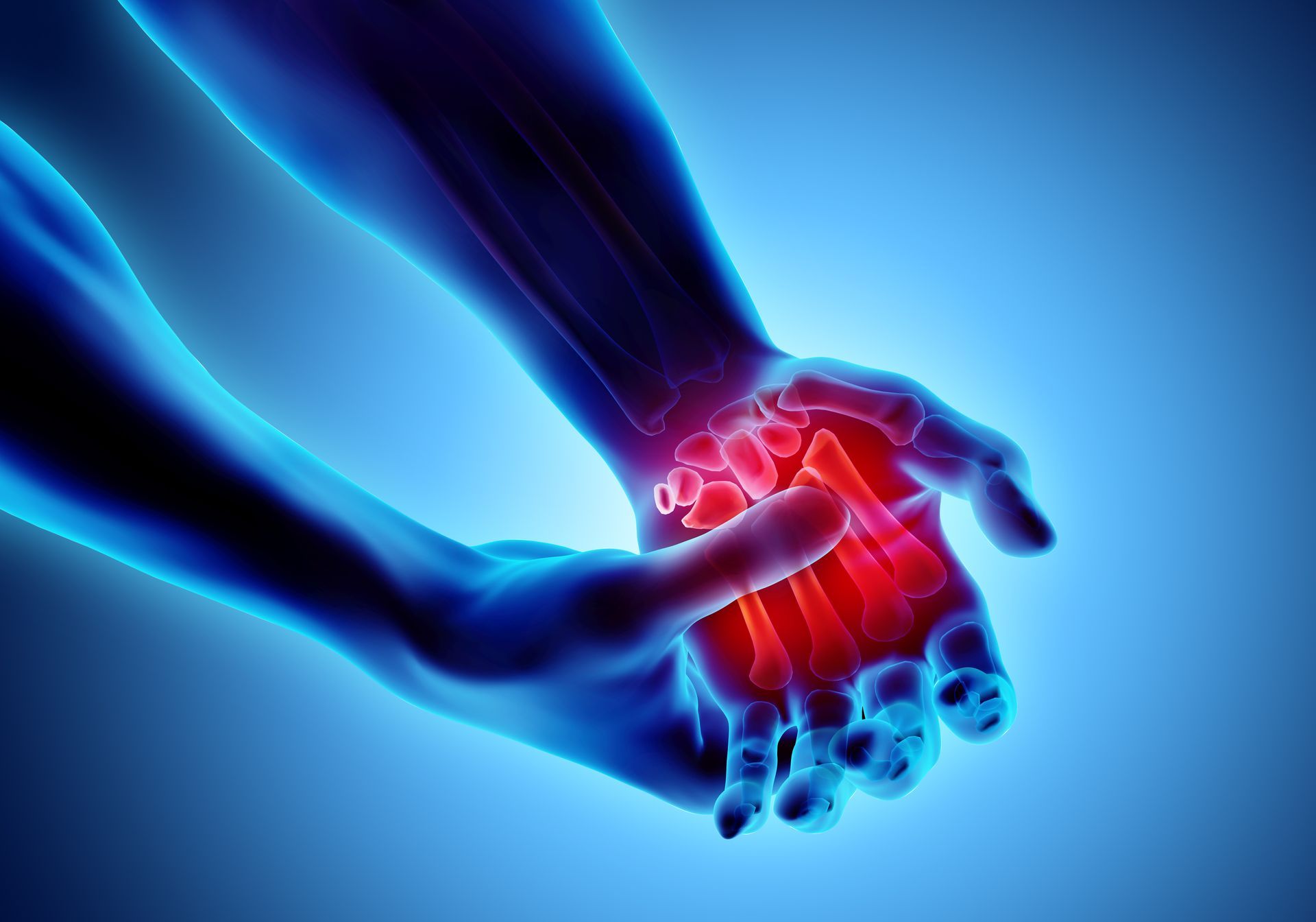 Eine Person hält vor Schmerzen ihr Handgelenk.