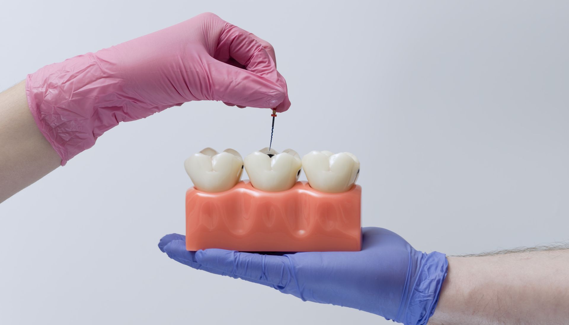 Gloved hands hold and probe a model of teeth and gums with a dental tool Gloved hands hold and probe a model of teeth and gums with a dental tool