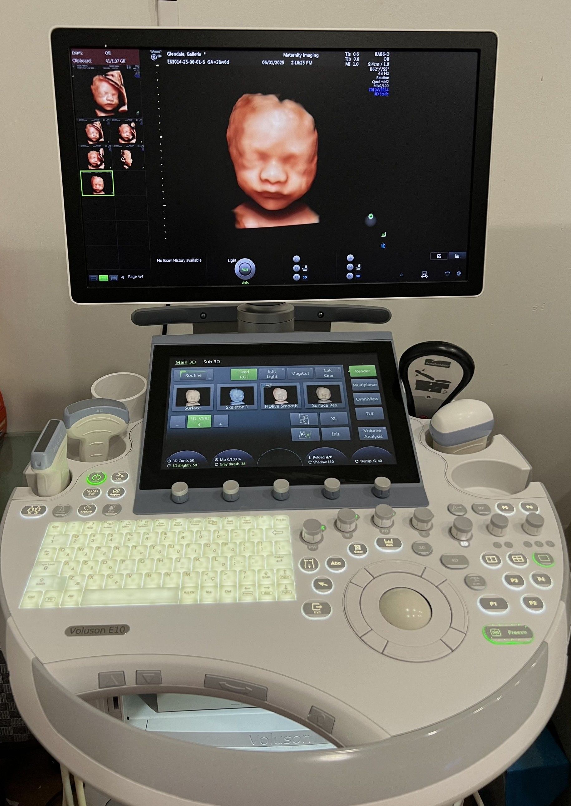 Pregnant Couple with Ultrasound Images — Glendale, CA — Maternity Imaging