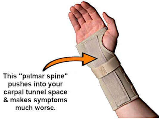 palmar spine on a wrist splint