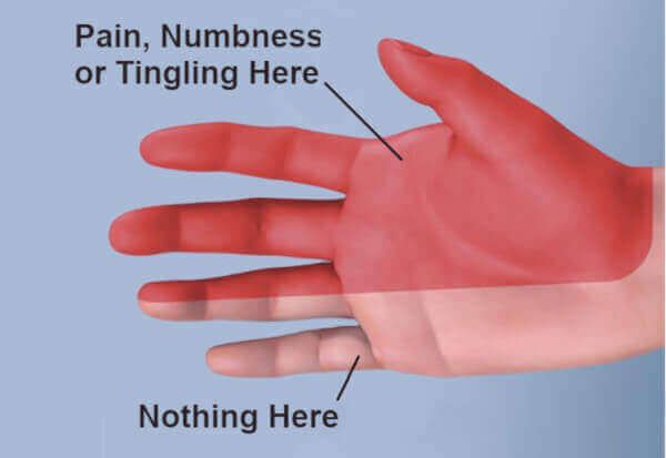 hands go numb when driving after 50 due to nerve pressure on the steering wheel