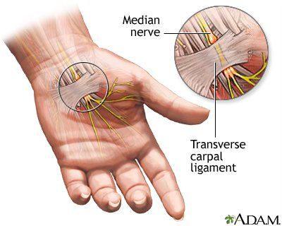 carpal tunnel and ligament