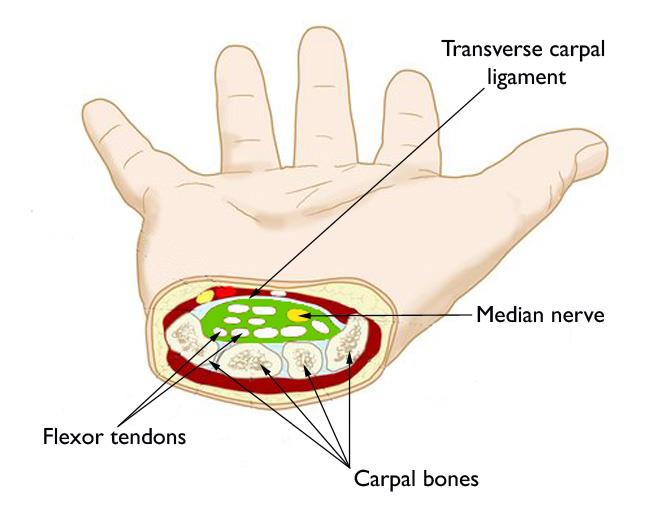 Diagram of a cross-section of the wrist, showing the carpal tunnel space.