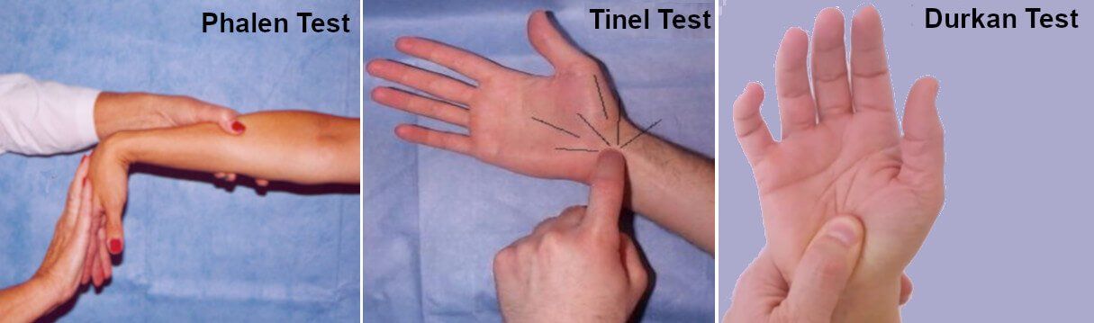provocative carpal tunnel tests