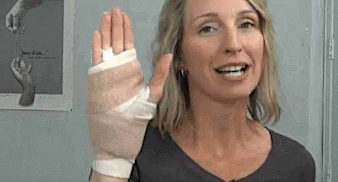 woman with bandaged hand after surgery