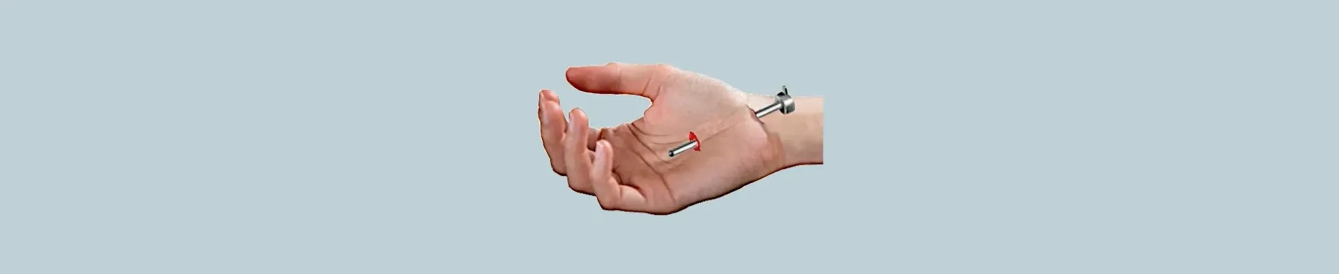 endoscopic surgery for carpal tunnel syndrome