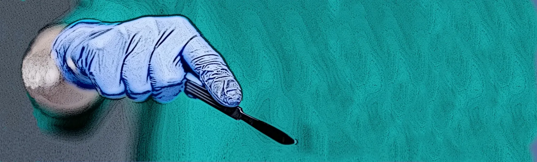 gloved hand holding a scalpel