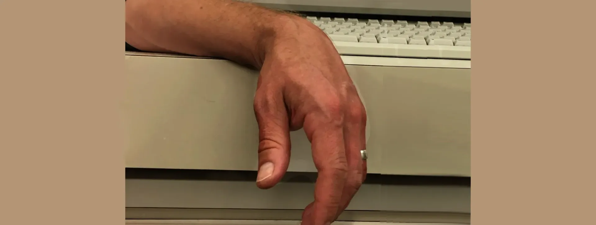 A dangling male hand depicting hand weakness.