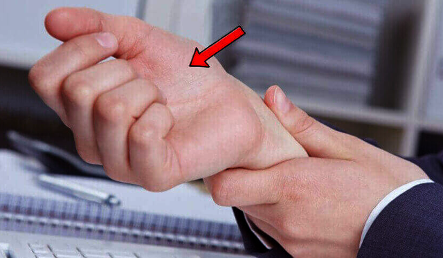 Comfy Dorsal Hand Orthosis