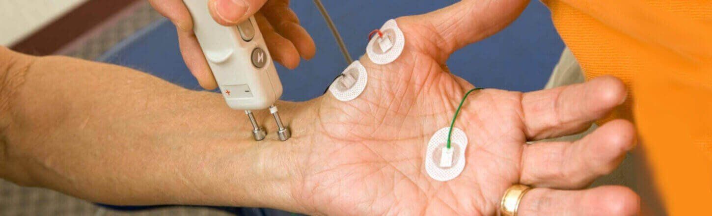 nerve conduction test