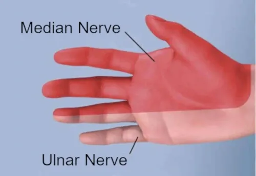 distribution of the median and ulnar nerves