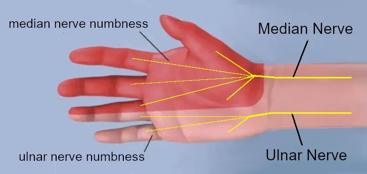 median and ulnar nerves