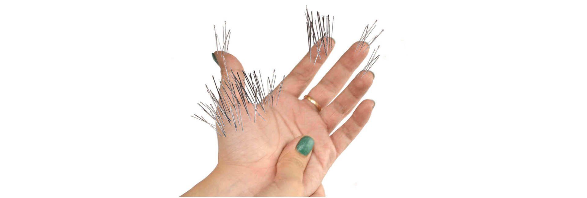 These are the Main Carpal Tunnel Syndrome Symptoms