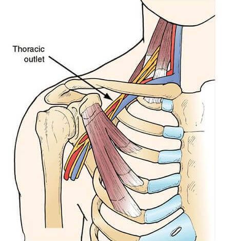 the thoracic outlet