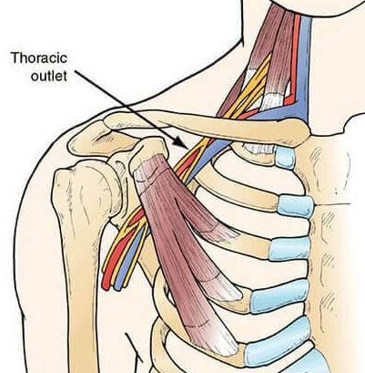 diagram showing the thoracic outlet