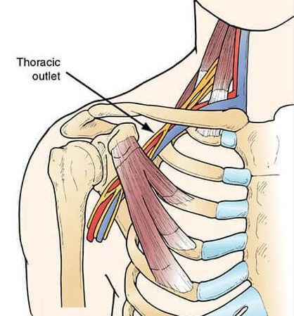 Location of your thoracic outlet, which causes thoracic outlet syndrome.