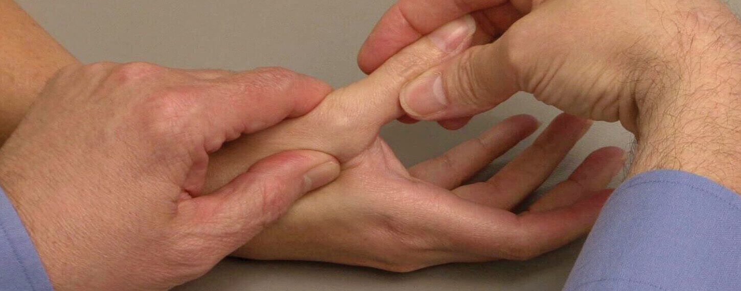 Doctor examines a patient's thumb