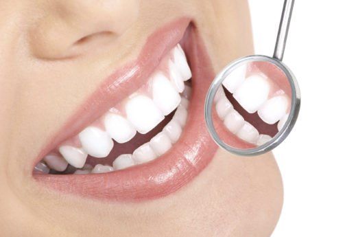 close up of woman teeth, all about dental veneers blog