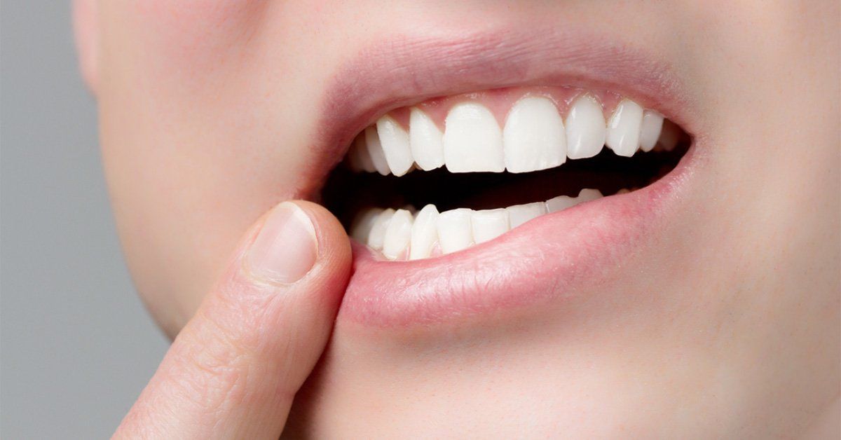 "Why Do My Gums Hurt?" Here's Why.