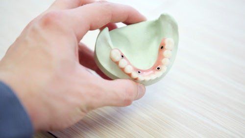 person-holding-model-of-teeth-mounted-on-light-green-mold