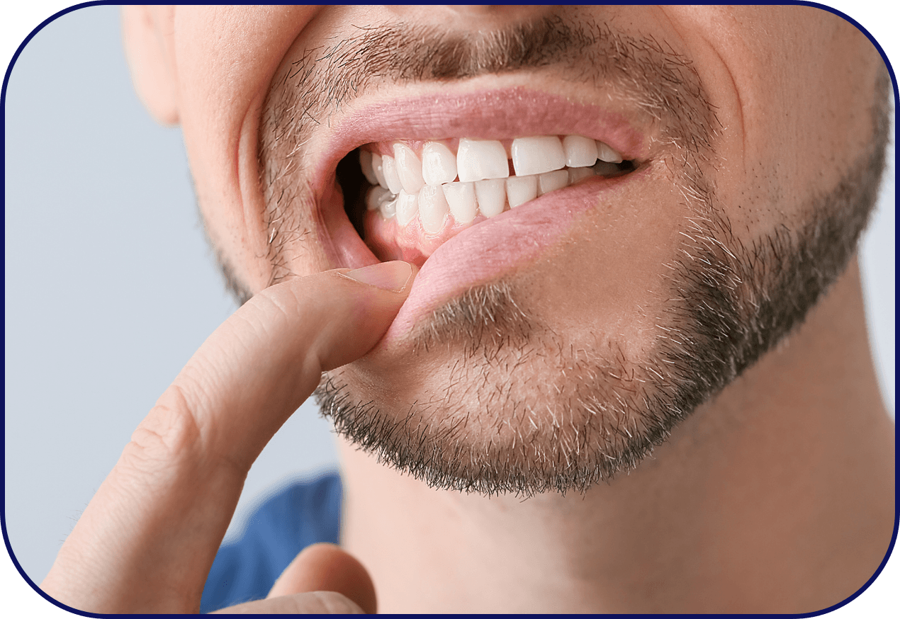 Man checking his teeth for aches with finger