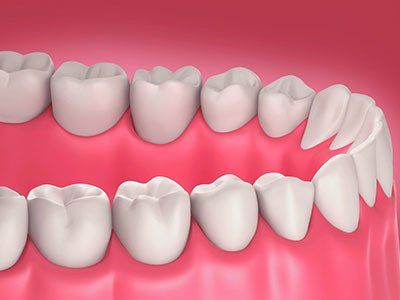 riproduzione 3d denti