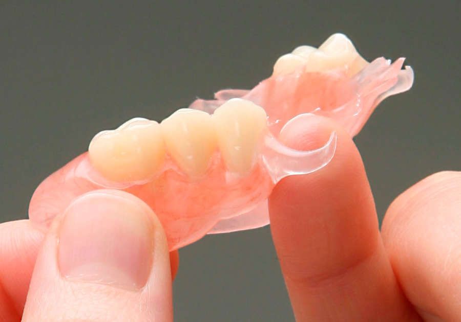 protesi dentale rimovibile