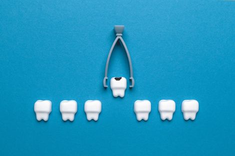 tooth extraction model