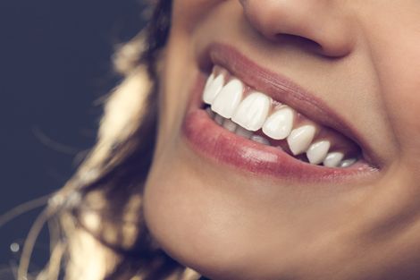 patient smiling after teeth whitening