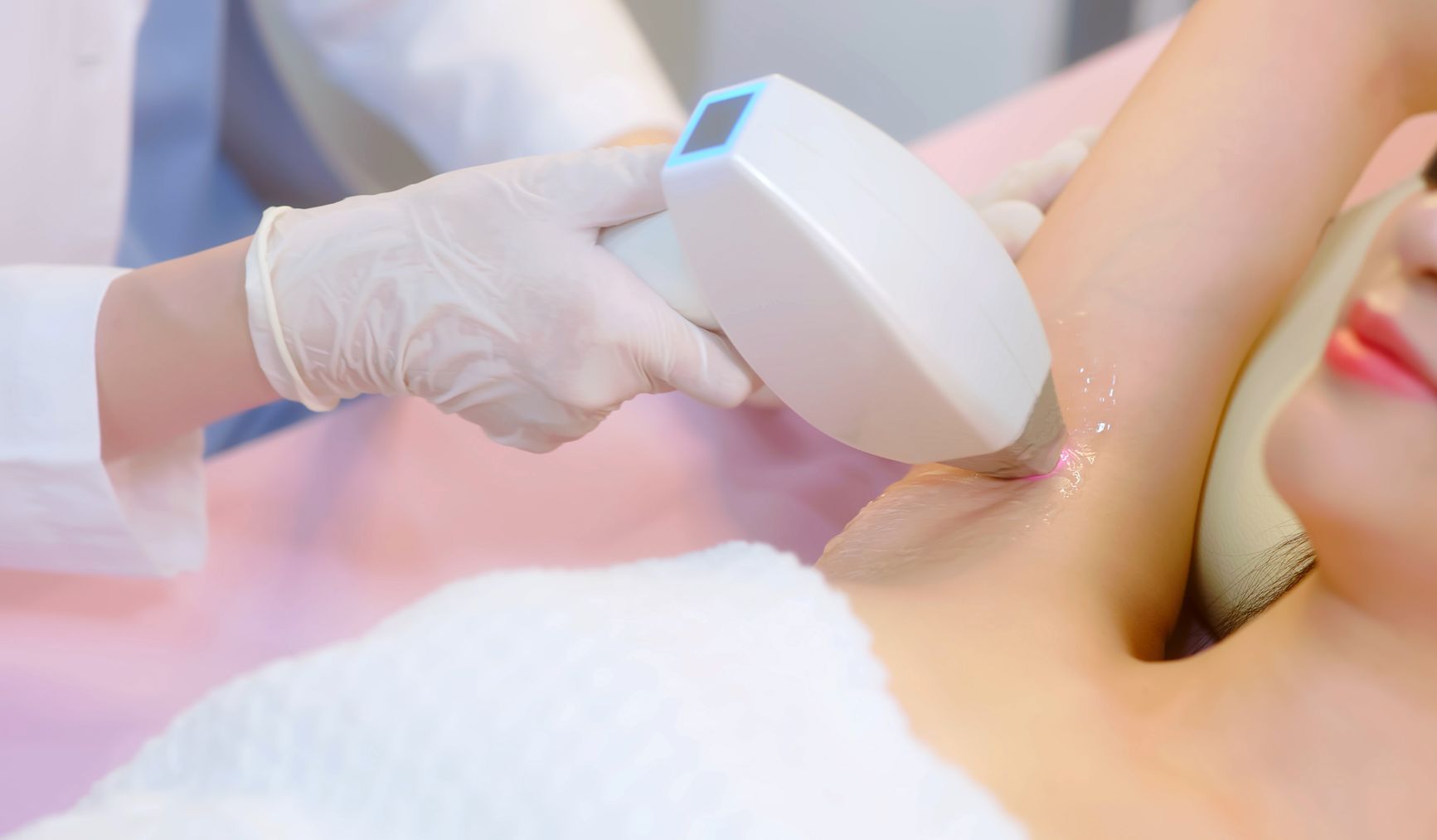 Una donna si sta sottoponendo a un trattamento di epilazione laser sulle ascelle.