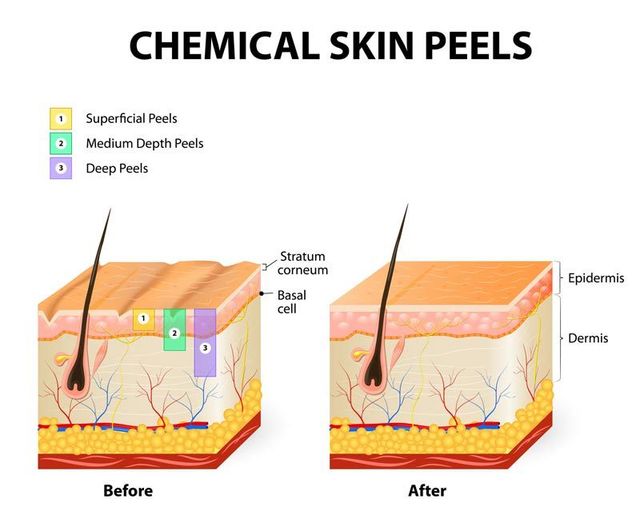 glutathione skin lightening houston Houston Skin Conditions main image 0