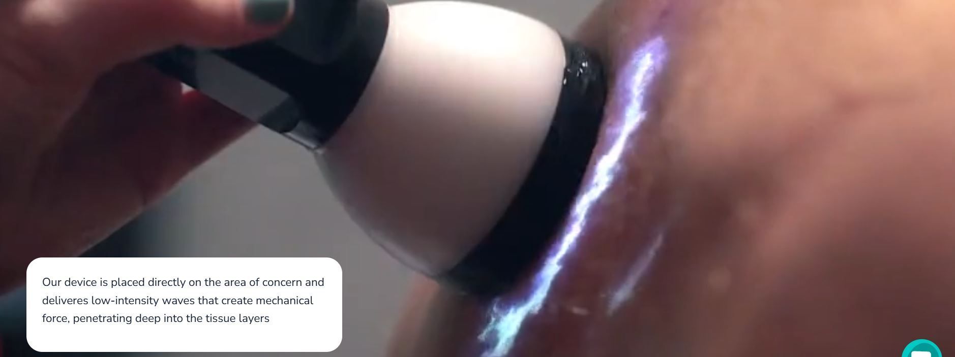 Person using the shockwave device that emits blue light on skin. Device is held in hand.