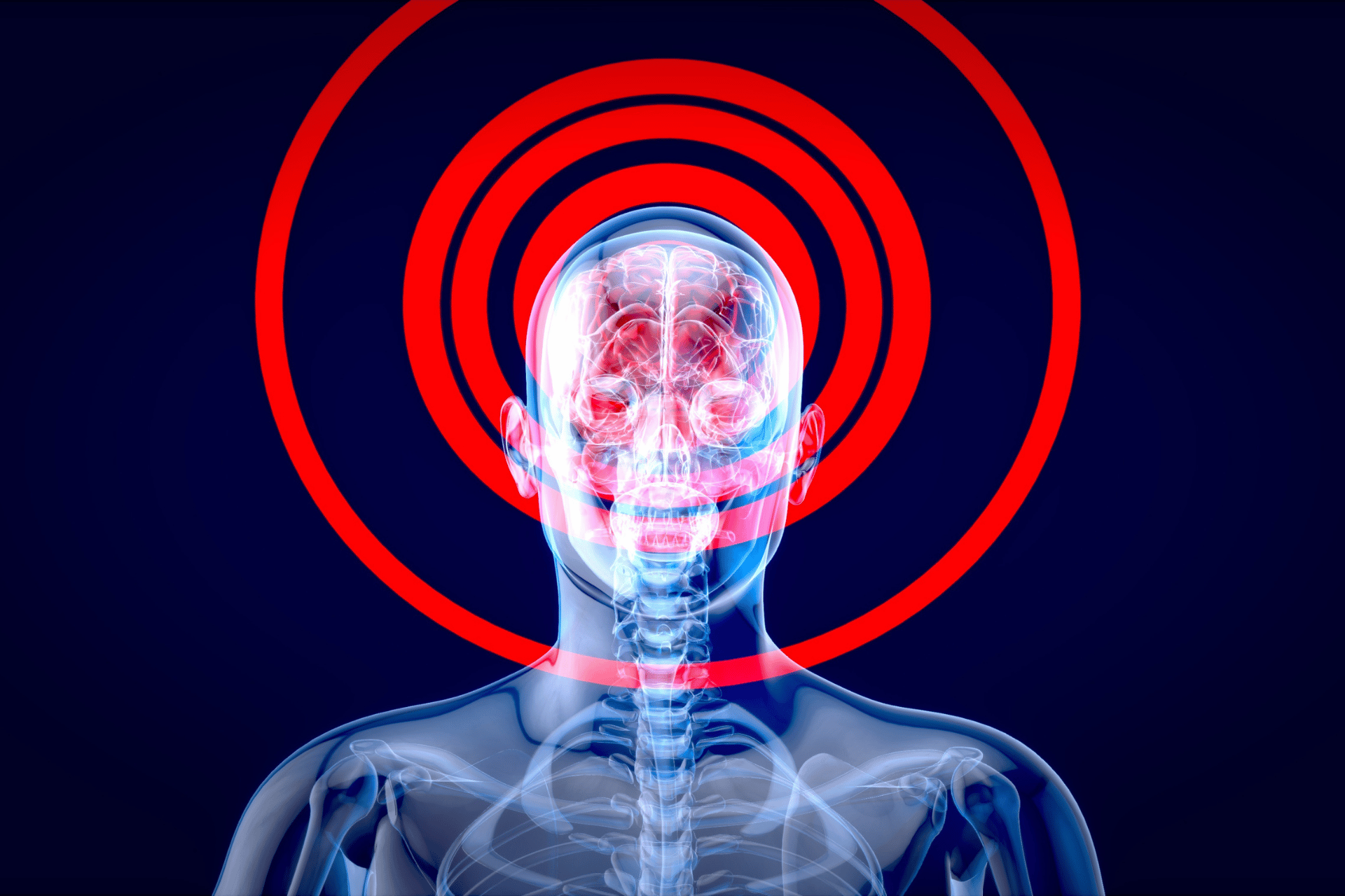 x-ray of a human with signals radiating from the head