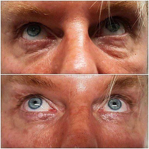 Cosmetic Surgery Before and after 3