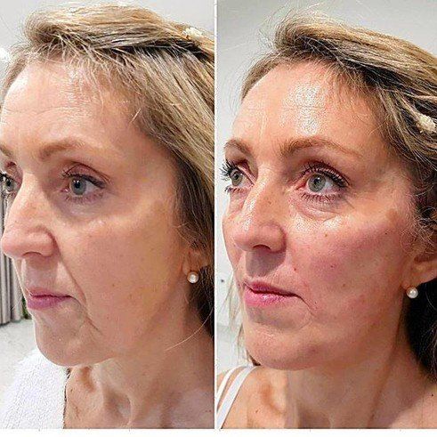 Cosmetic Surgery Before and after 2