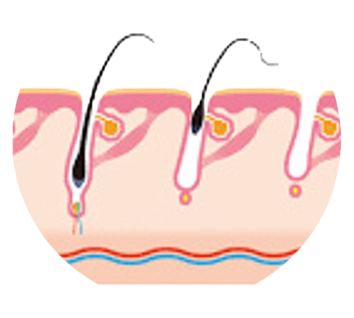 Head first Treatment