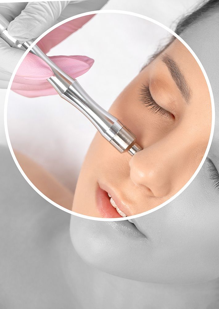 Microdermabrasion