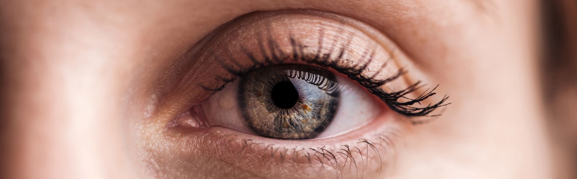 O que causa astigmatismo O que causa astigmatismo
