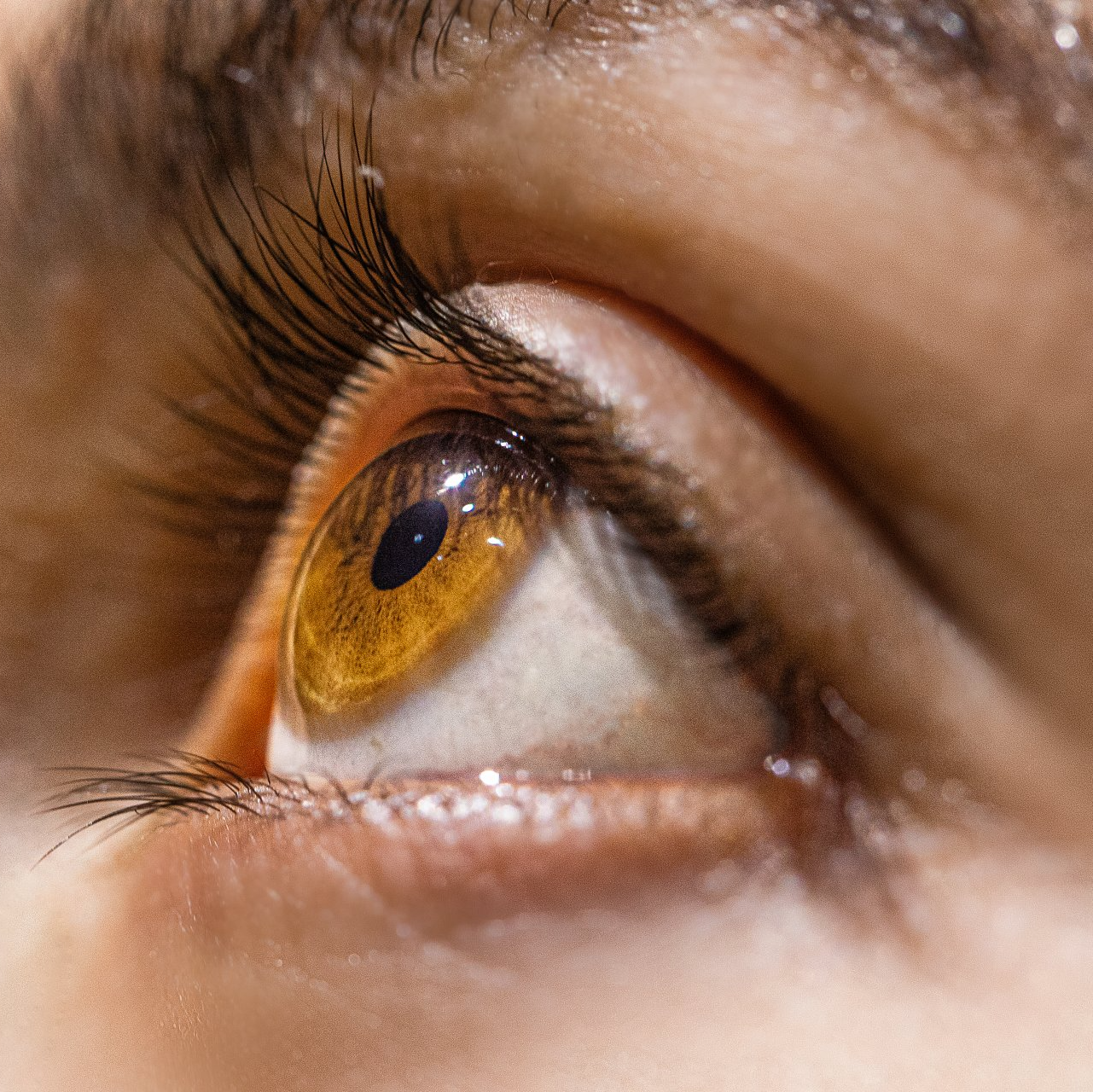Clínica para Injeção Intraocular em Jundiaí Clínica para Injeção Intraocular em Jundiaí