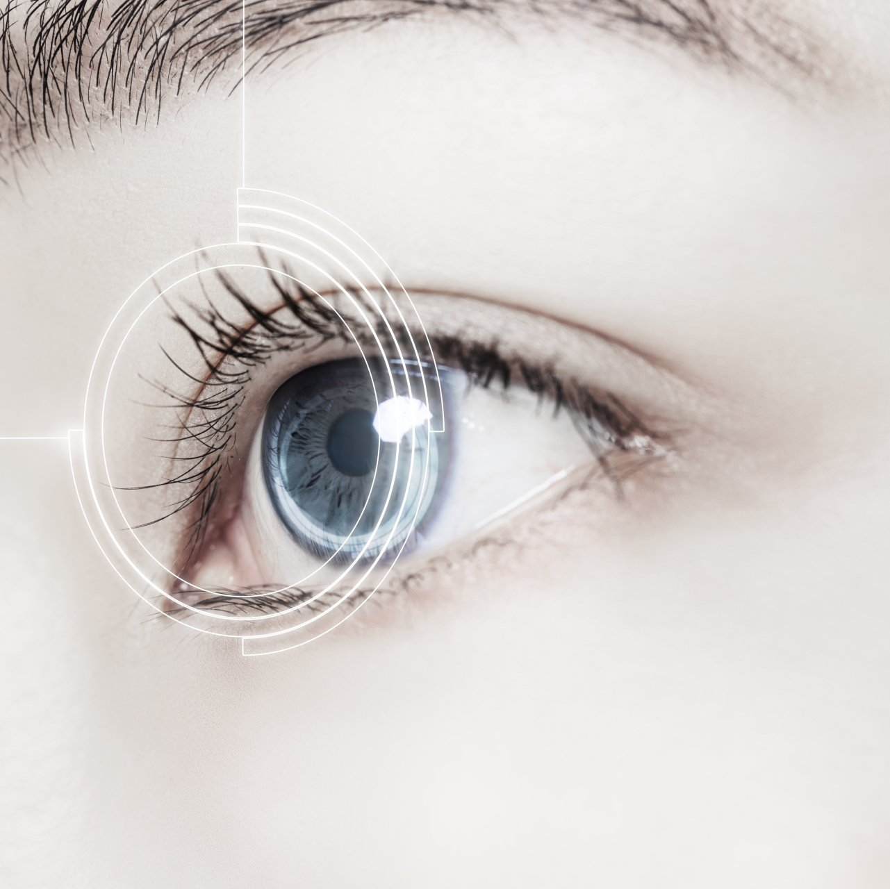 Tratamento para astigmatismo em Jundiaí Tratamento para astigmatismo em Jundiaí