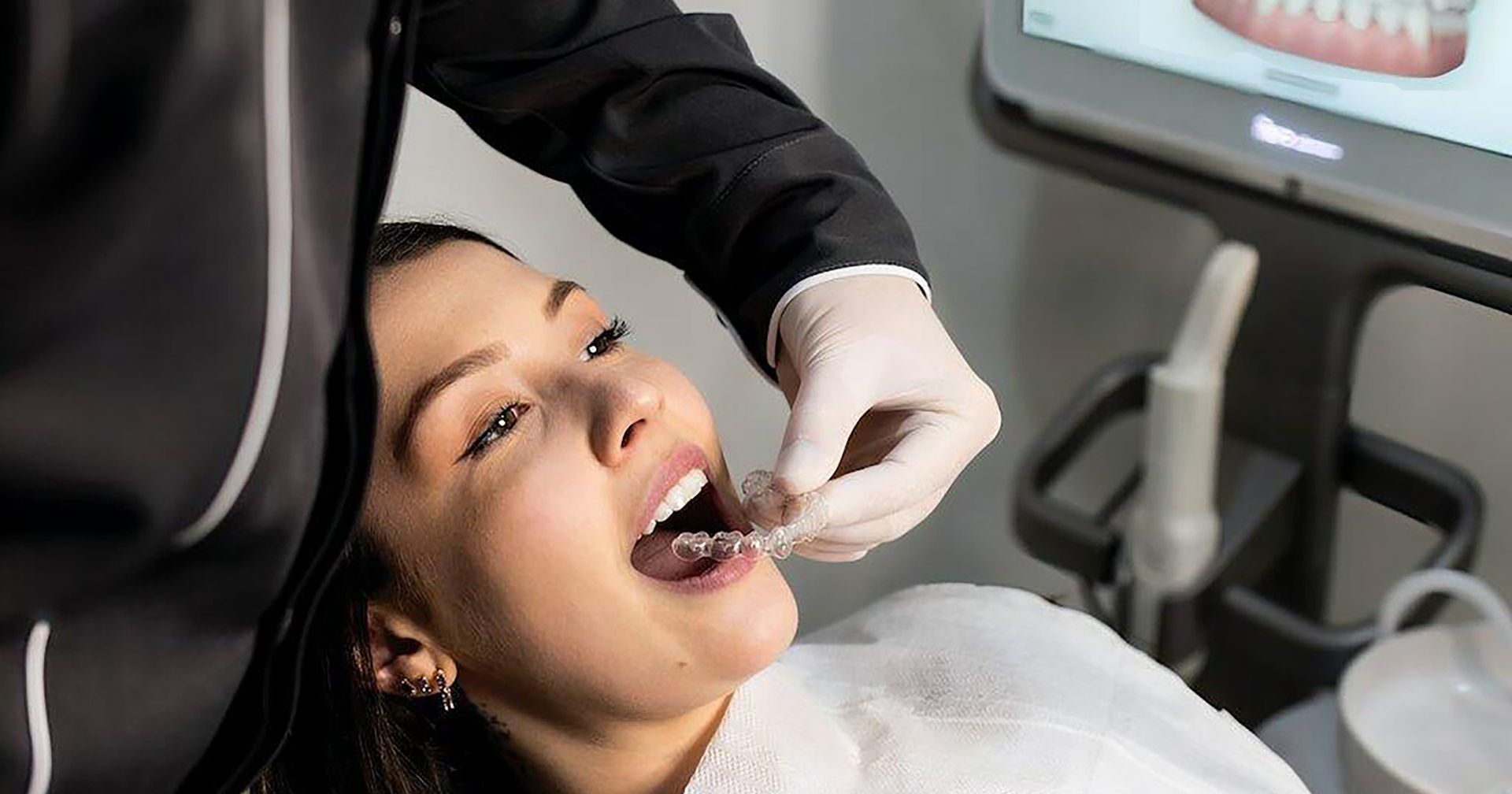 smile makeover