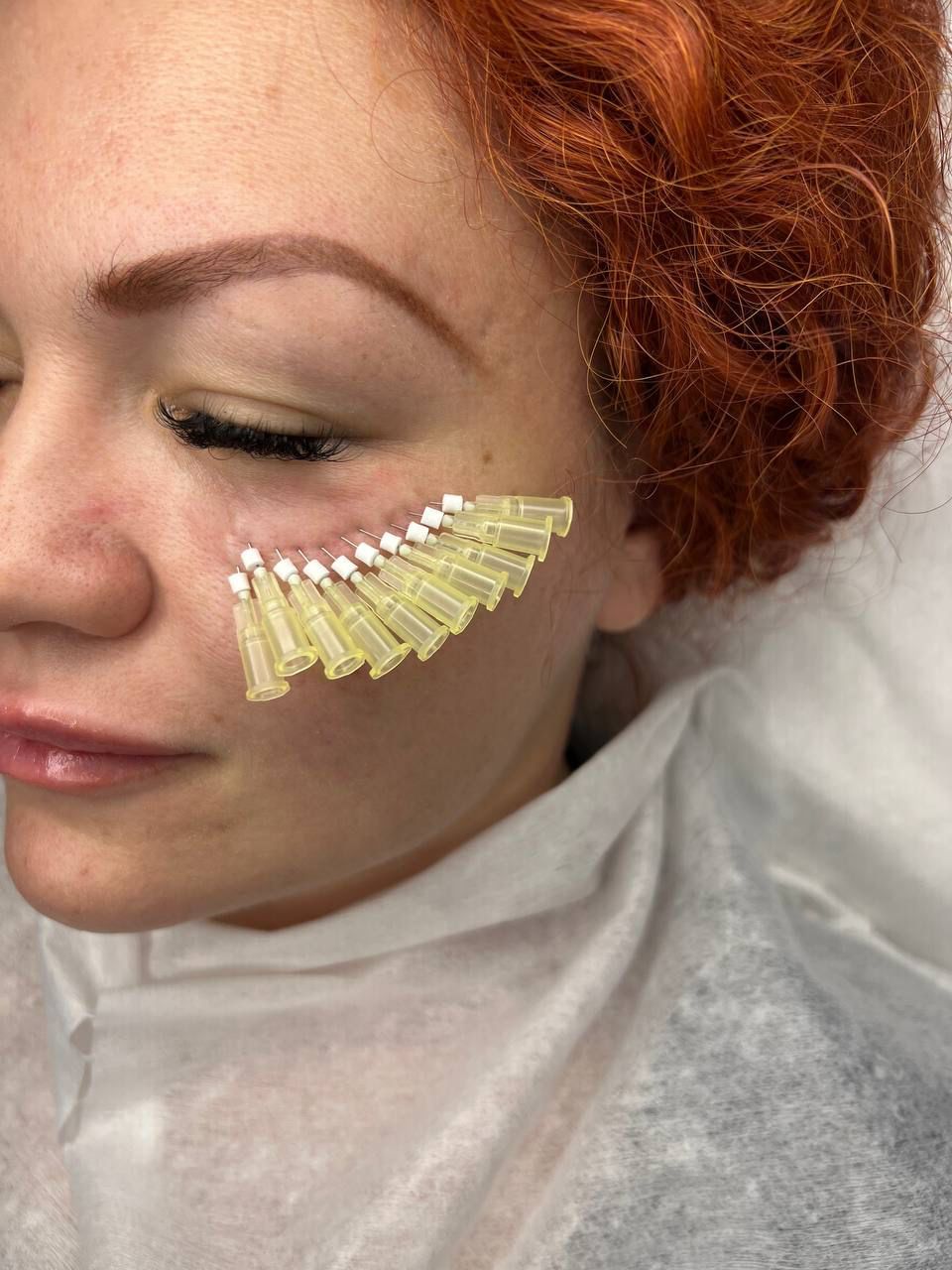 Eine Frau mit roten Haaren bekommt eine Gesichtsbehandlung.