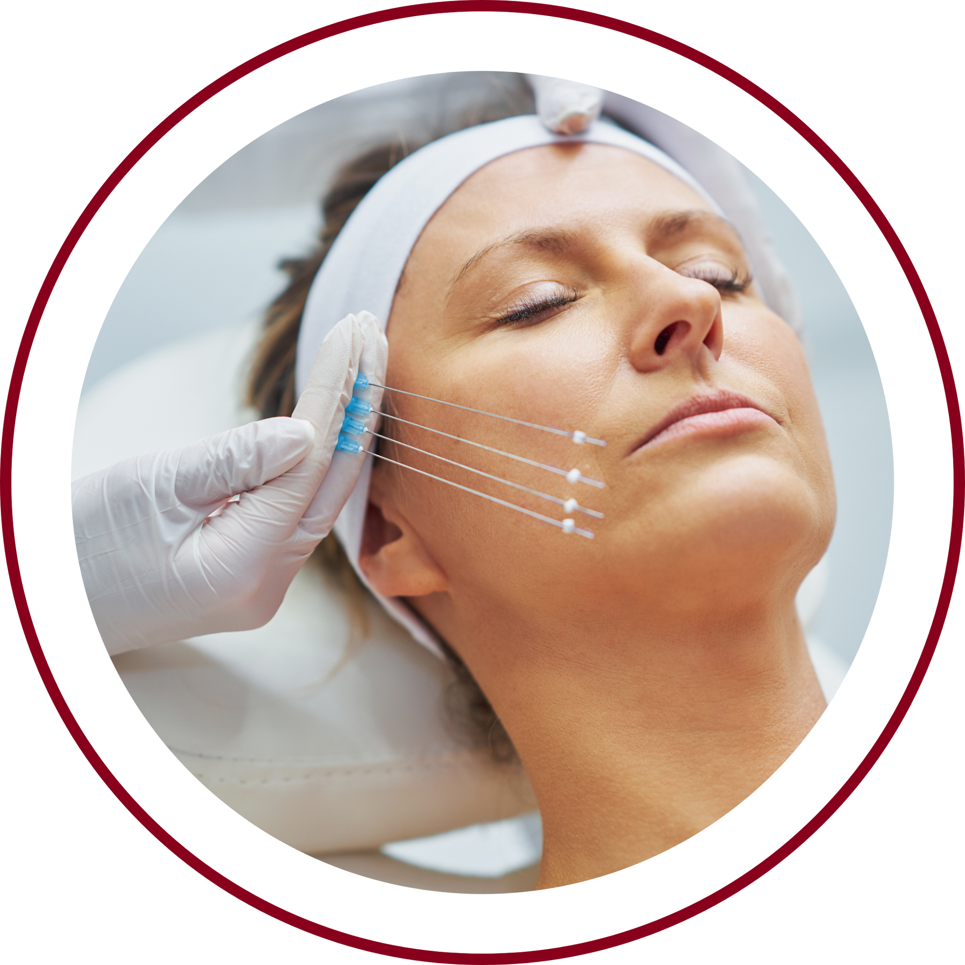 Eine Frau bekommt eine Botox-Injektion ins Gesicht.