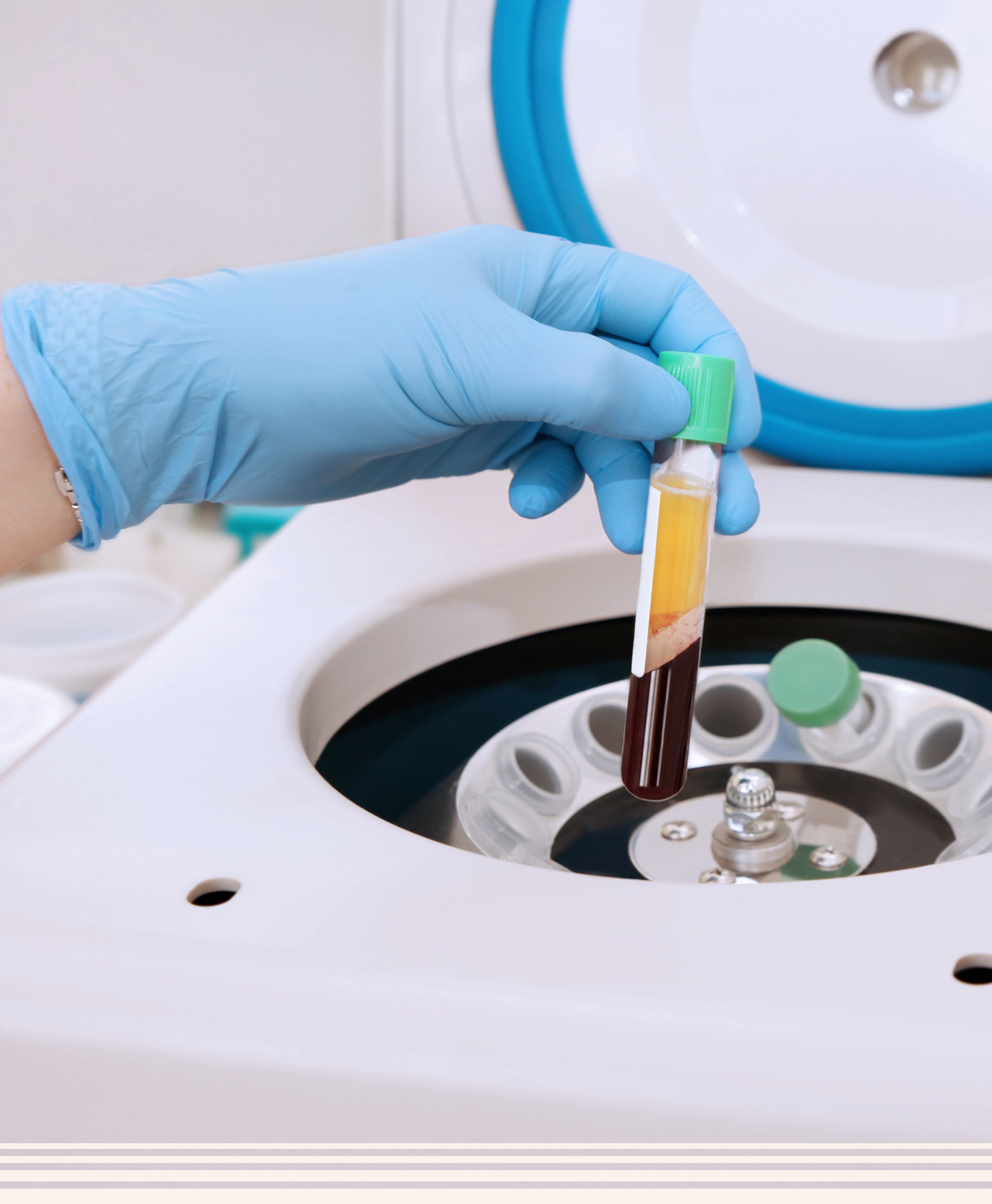 Blutplasma wird in ein medizinisches Gerät eingefügt