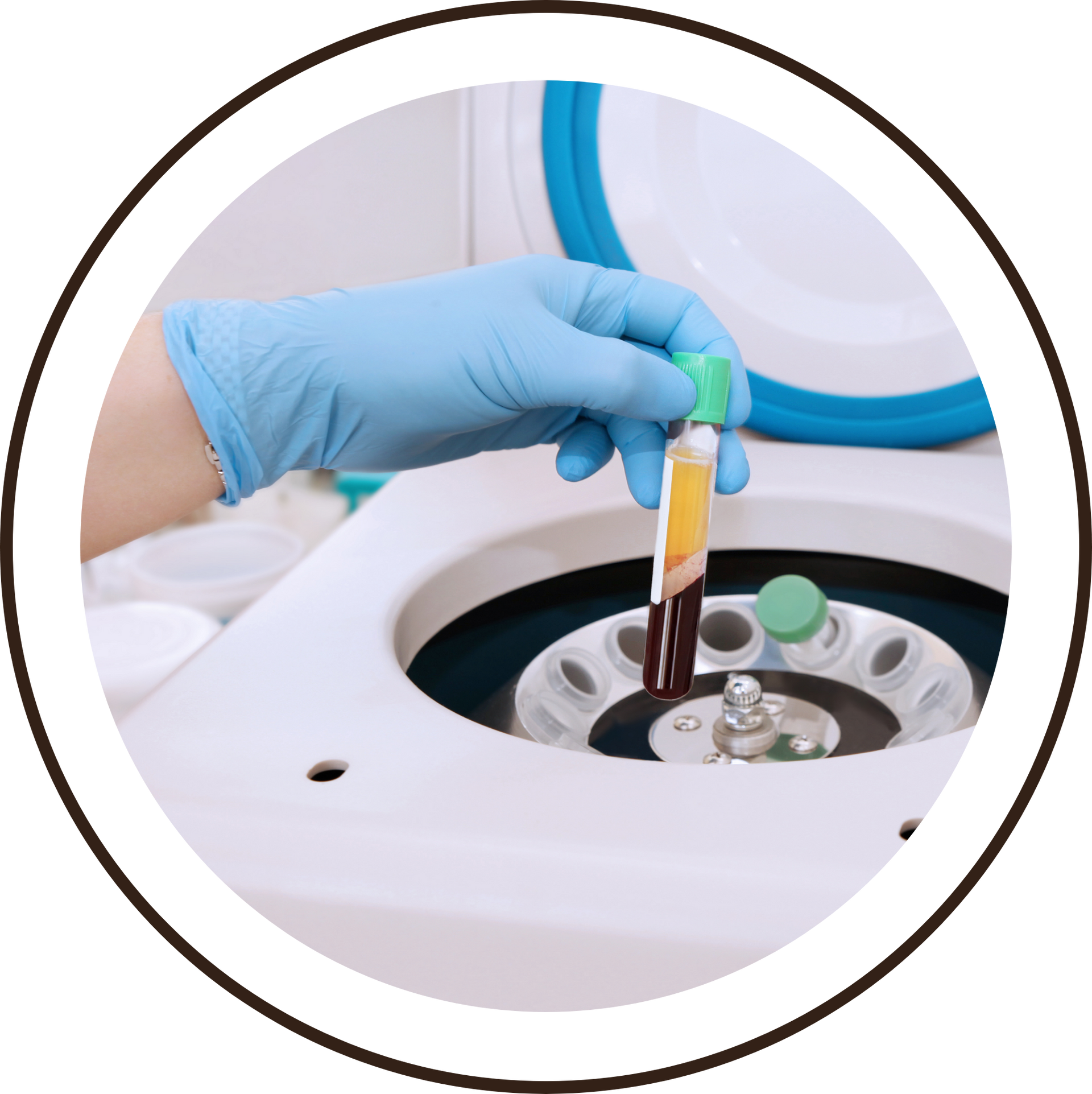 Blutplasma wird in ein medizinisches Gerät eingefügt