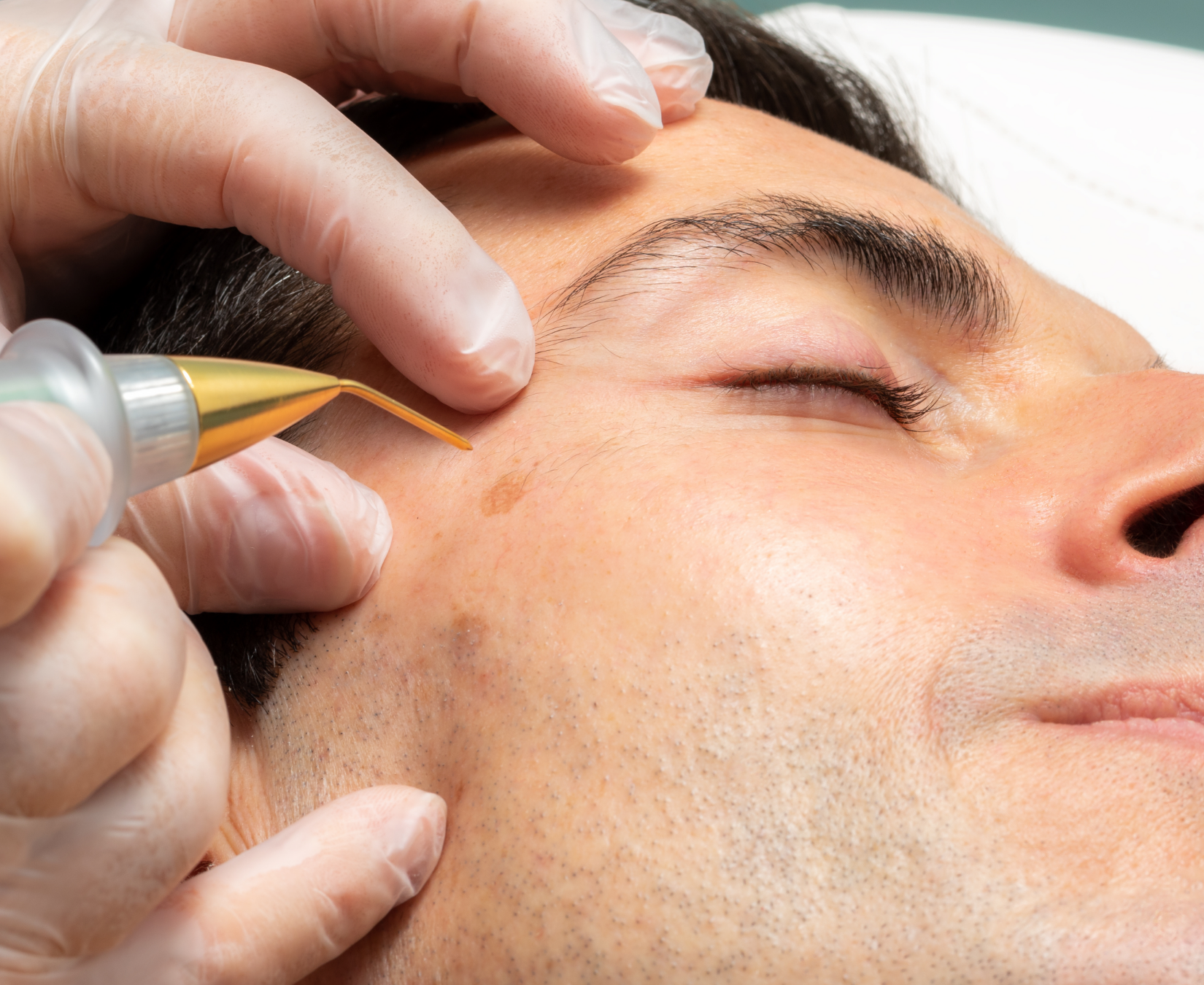 Ein Mann bekommt eine Gesichtsbehandlung