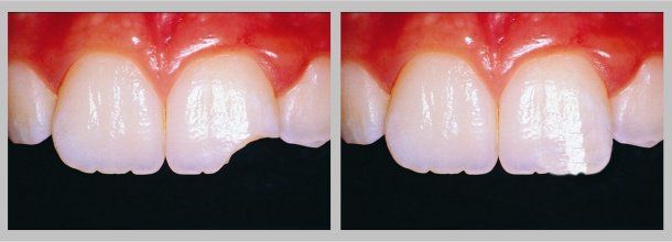 Skateboard: Before/After