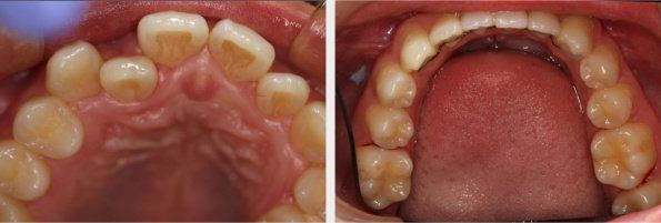 Orthodontics 1